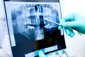 Ortodoncja - Klinika DENTAL ART w Gdyni